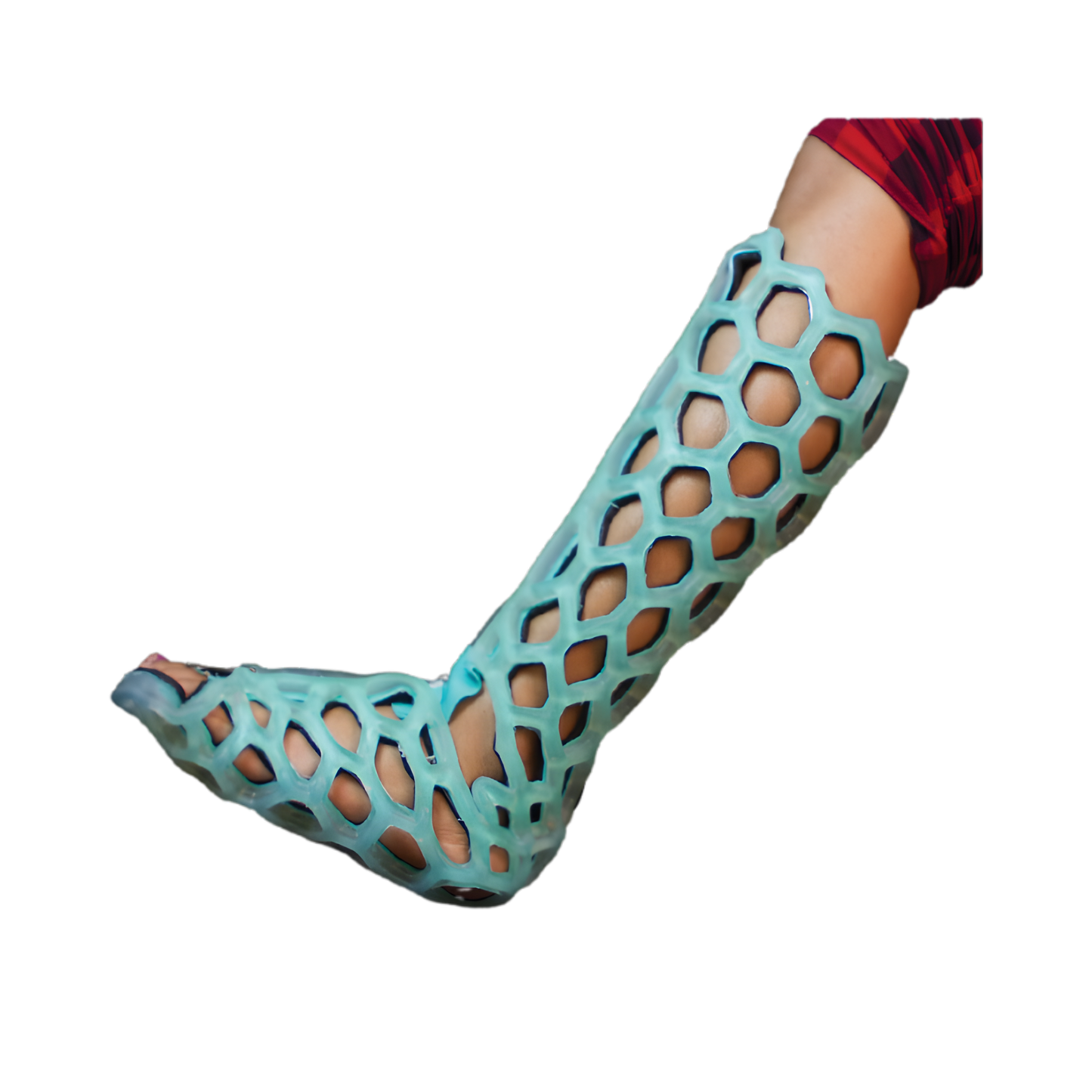 FlexiCast Short Leg Immobilizer