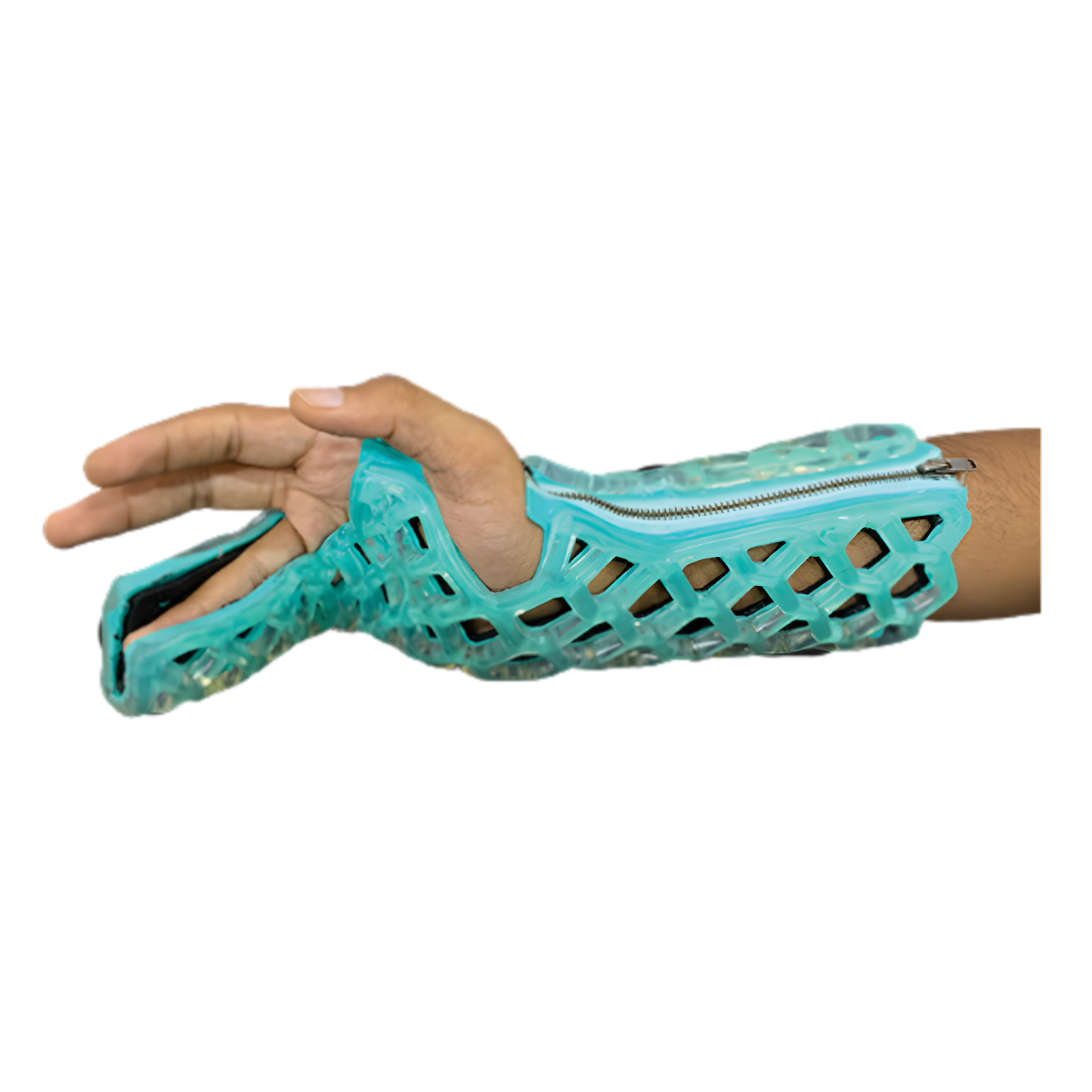 FlexiCast Ulnar Gutter Immobilizer